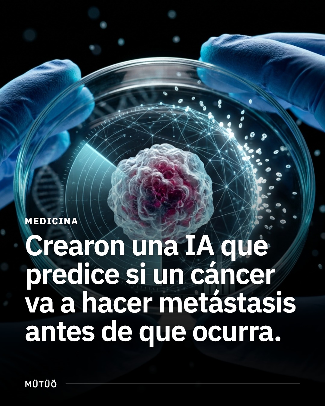Una IA predice si un cáncer va a hacer metástasis antes de que ocurra